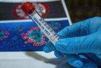 На Буковине за сутки зафиксировали 193 случая коронавируса